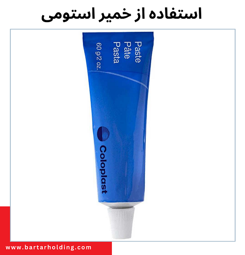 نحوه استفاده از خمیر استومی کلوپلاست