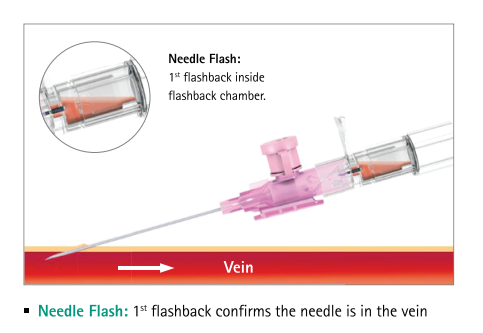 Needle Flash