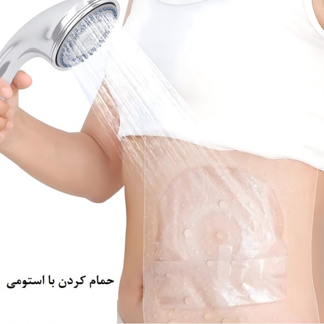حمام کردن با استومی
