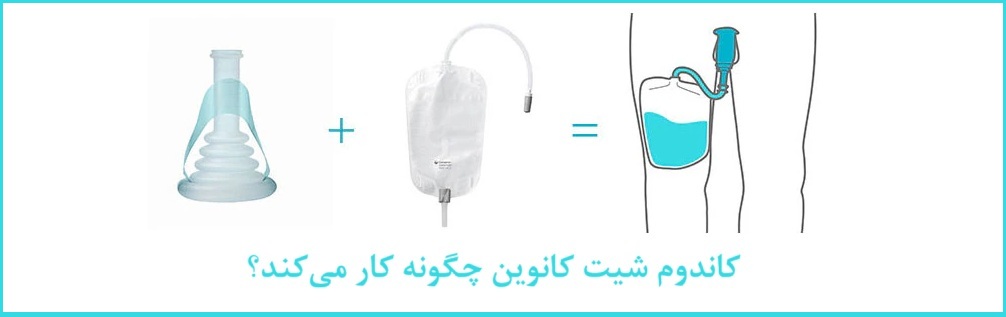 کاندوم شیت کانوین چگونه کار میکند؟