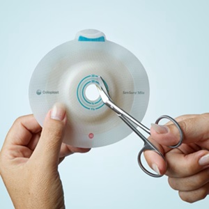 تعویض کیسه استومی